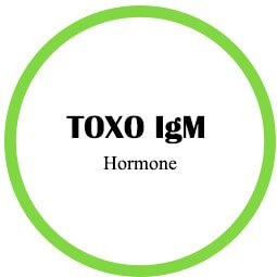 Toxo IgM